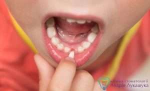 Когда начинают выпадать молочные зубки?